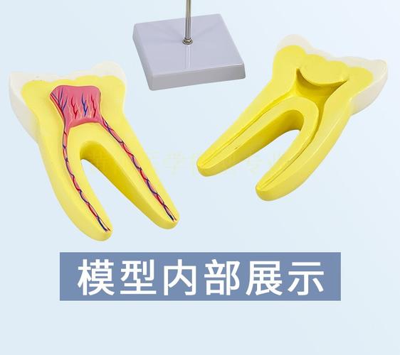 人体磨牙放大模型 分拆2部件 牙齿解剖 玩具 幼儿园教具 牙科展示